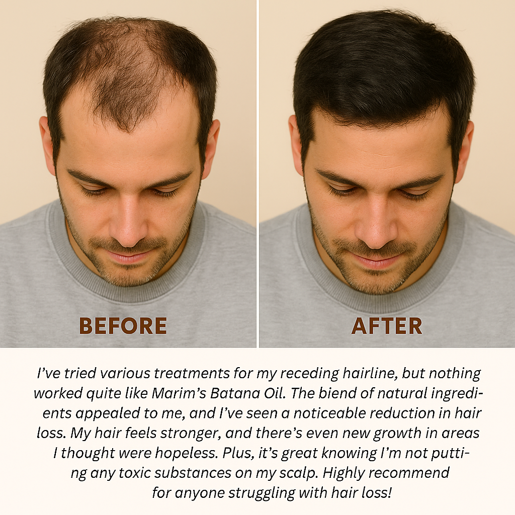 Batana Oil Natural Hair Growth